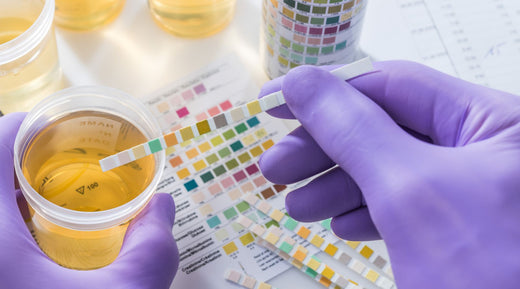Pack associant tests de boisson et dépistage biologique pour la prévention de la soumission chimique