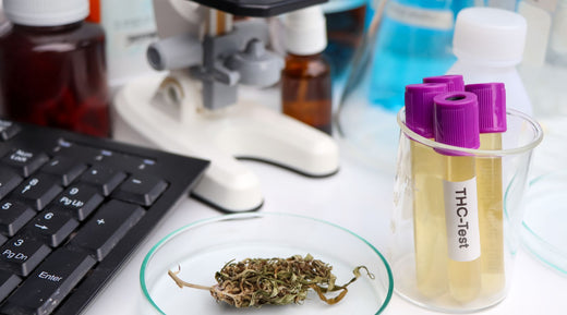 Échantillon d’urine en laboratoire pour un test de dépistage de drogues